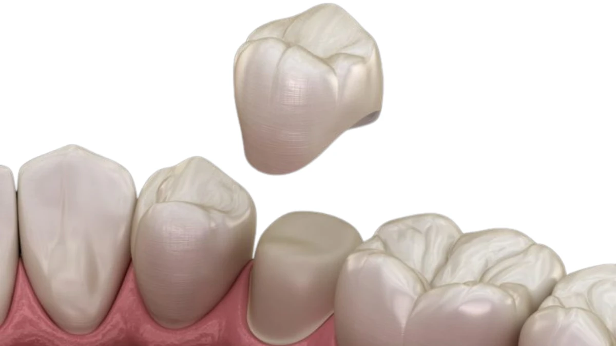 Dental Crowns Wasilla